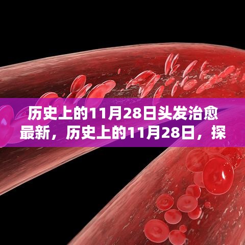 歷史上的11月28日，探尋頭發(fā)治愈的最新篇章??