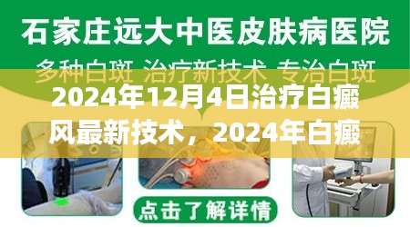 2024年白癜風(fēng)治療最新技術(shù)解讀與應(yīng)用前景展望，革新與未來(lái)趨勢(shì)