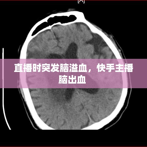 直播時(shí)突發(fā)腦溢血，快手主播腦出血 