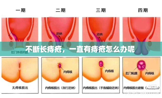 不斷長痔瘡，一直有痔瘡怎么辦呢 