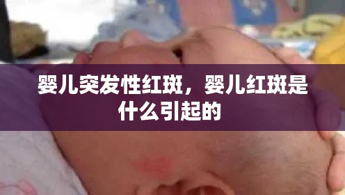 嬰兒突發(fā)性紅斑，嬰兒紅斑是什么引起的 