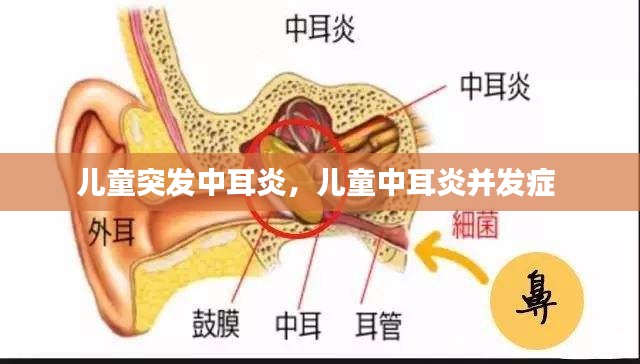 兒童突發(fā)中耳炎，兒童中耳炎并發(fā)癥 